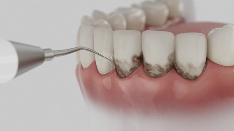 Trusted Dental Crowns And Bridges service in Wagoner, OK - Dentist Open Now